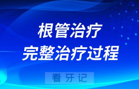 根管治疗完整治疗过程步骤最新整理