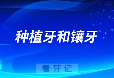 种植牙和镶牙有哪些区别整理介绍