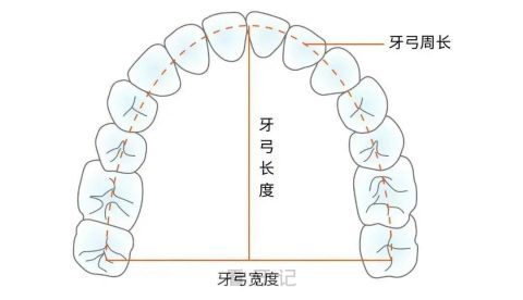 扩弓矫正是什么是否靠谱会不会让脸变大