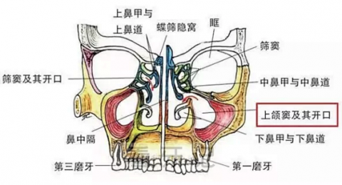 什么是上颌窦？种植牙为什么要做上颌窦提升术