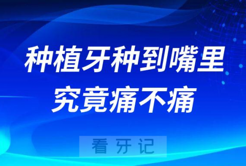 种植牙太吓人了种植牙怎么种到嘴里究竟痛不痛