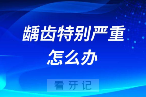 蛀牙龋齿烂牙特别严重怎么办附四大治疗手段