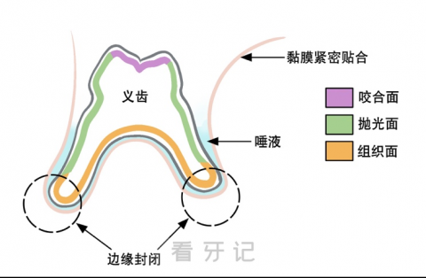 什么是吸附性义齿附真实图片