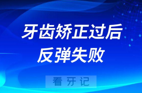 后悔正畸了牙齿矫正过后又反弹失败了怎么办