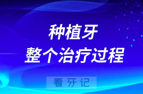 为什么种植牙整个治疗过程要好几个月这么久