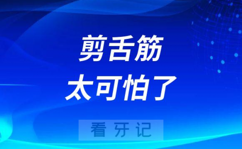 剪舌筋太可怕了要不要让孩子舌系带挨这一剪刀