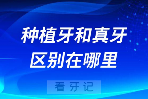 别吹了种植牙和真牙有区别完全不一样