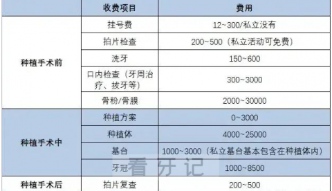 种植牙费用三大收费方式