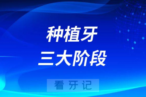 种植牙全过程一共要多长时间附三大阶段