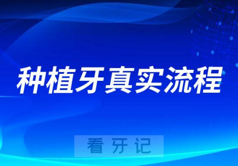 种植牙真实流程图片解说最新完整版