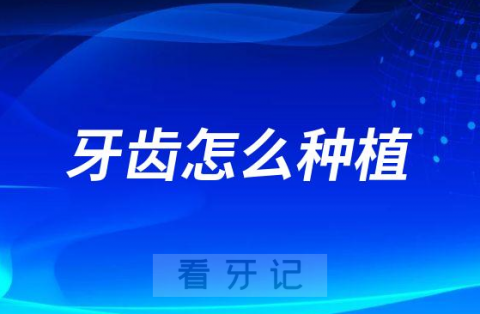 牙齿怎么种植是否牢固