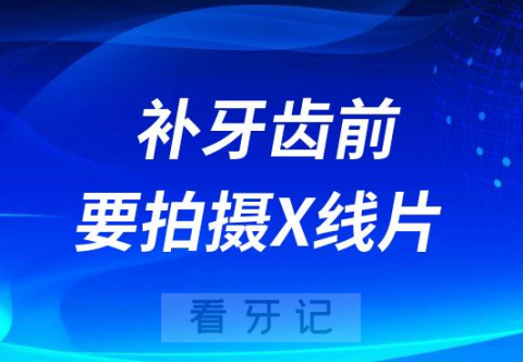 补牙齿为什么要拍摄X线片有没有危害