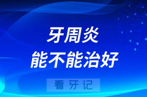 牙周炎能不能治好治疗费贵不贵