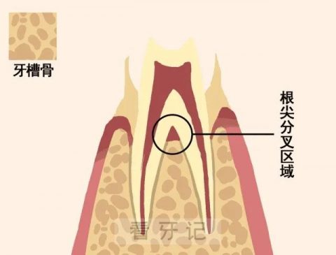 牙槽骨吸收症状有哪些具体表现