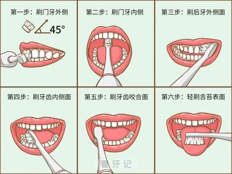 种植牙应该如何刷牙最靠谱