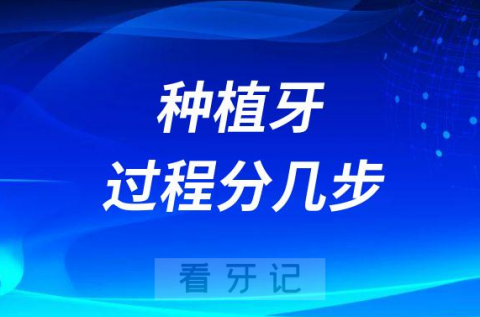 种植牙的过程步骤一共分几步