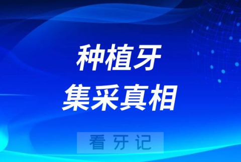 种植牙集采真相大揭秘