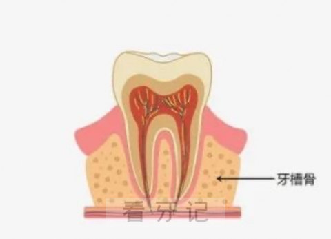 牙槽骨萎缩骨吸收是什么意思