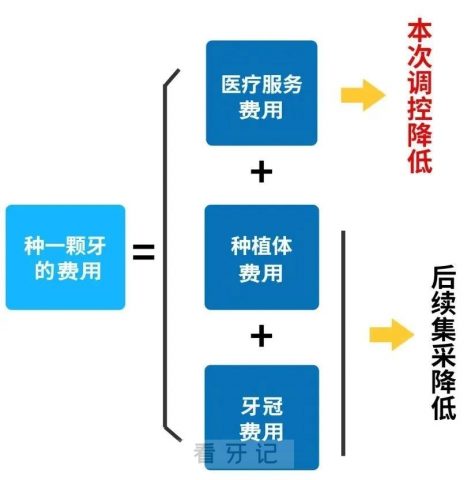 国家种植牙集采降价降在哪里具体降了多少