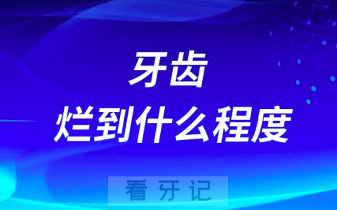 牙齿烂到什么程度就必须要拔牙了附烂牙图片