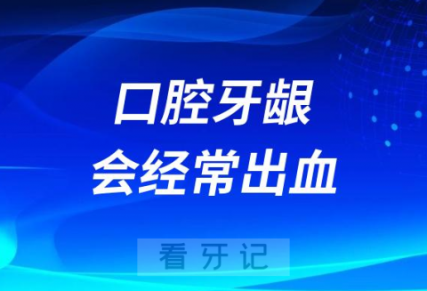 太可怕了为什么口腔牙龈会经常出血附四大原因