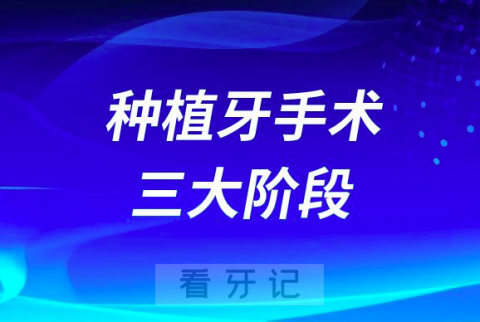 梧州市****种植牙价格出炉附集采政策