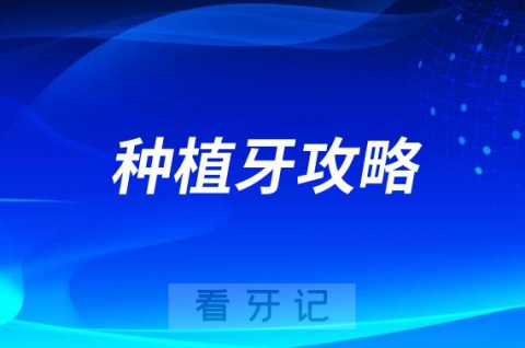 种植牙攻略教程2023最新版含优缺点寿命人群价格等