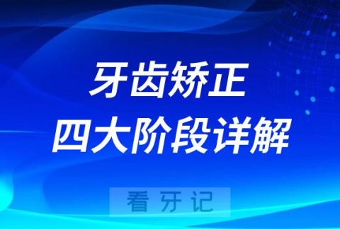 牙齿矫正需要多久附四大阶段详解