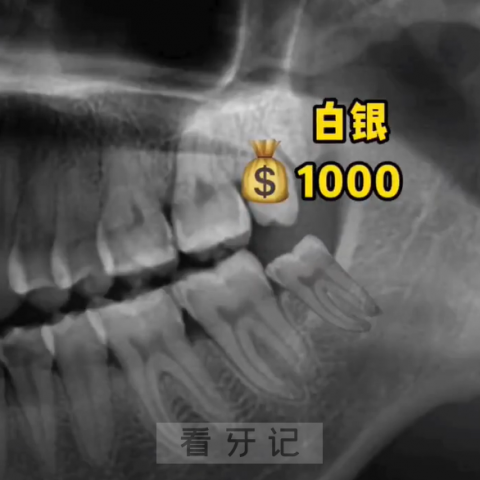 023最新十大智齿类型附拔智齿价格前十排行榜"