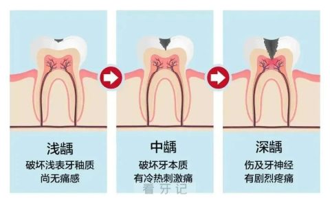 太可怕了牙齿突然间刺痛是怎么回事附图片