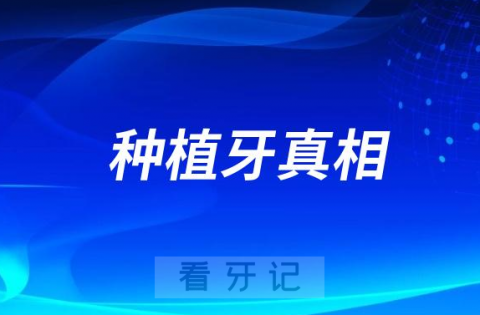 你的牙科医生未必会告诉你的种植牙真相