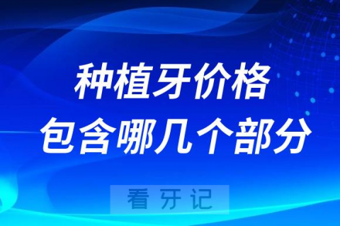 医院报价的种植牙价格一般包含哪几个部分