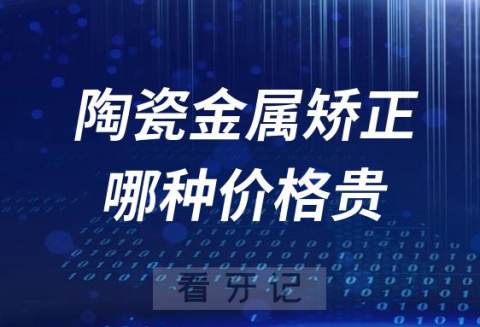 陶瓷矫正和金属矫正价格哪个价格最贵？