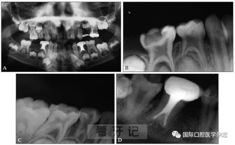 牛牙症是什么意思？最新图片解读来了