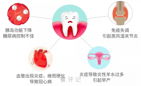 牙疼牙龈有些肿刷牙还会出点血是“上火”导致的吗？