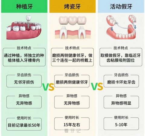 种植牙到底好在哪里？2023最新解读来了！