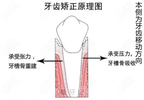 拔牙矫正后其他牙齿会更容易掉么？答案来了