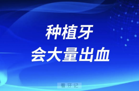 种植牙会大量出血是真的假的