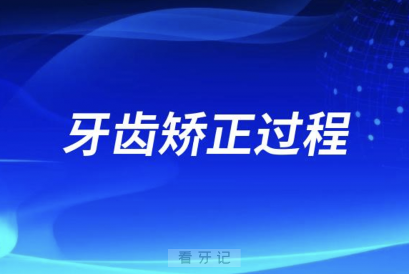 牙齿矫正过程三大步骤阶段