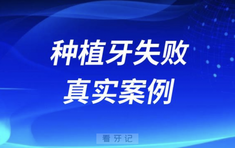 被种植牙害苦了真实案例