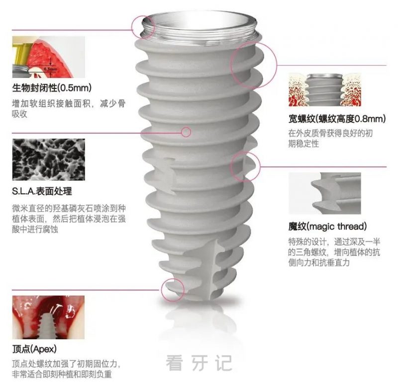 韩国纽白特种植体最新官方介绍