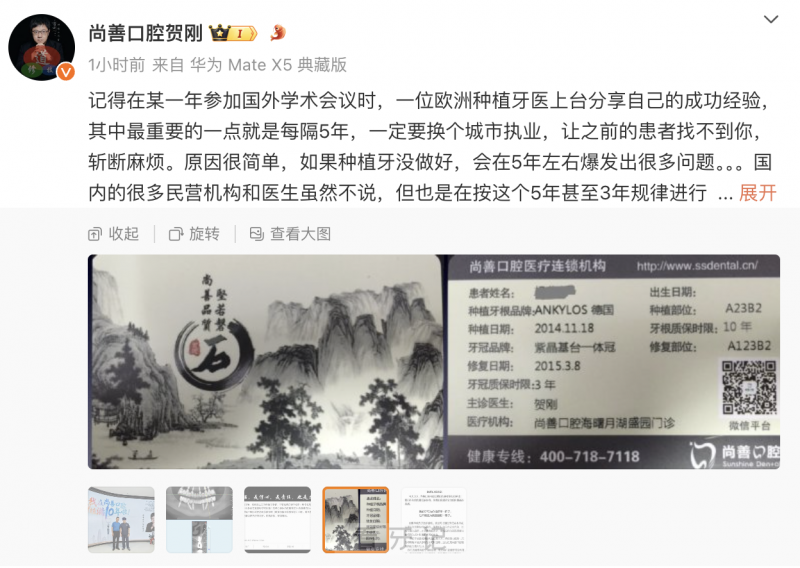 尚善口腔的贺刚做种植牙怎么样？