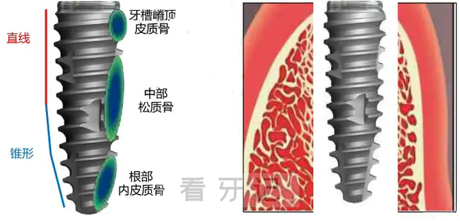 韩国纽白特种植体最新官方介绍