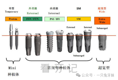 瑞士ITI和瑞典诺贝尔种植体好在哪里？