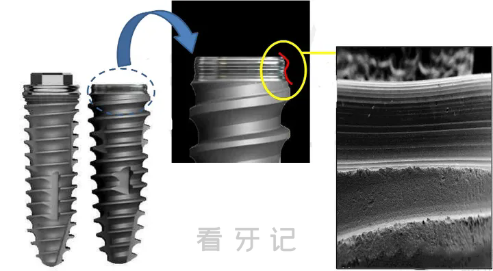 韩国纽白特种植体最新官方介绍