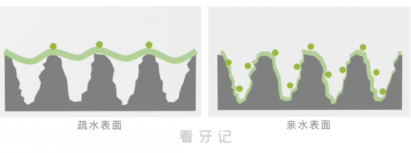 亲水种植体和非亲水种植体该怎么选？