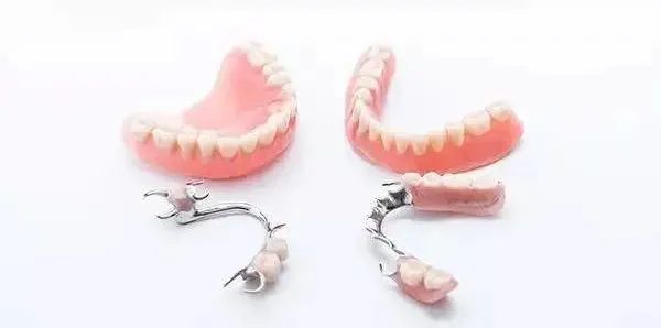 活动假牙和固定假牙哪种更好？
