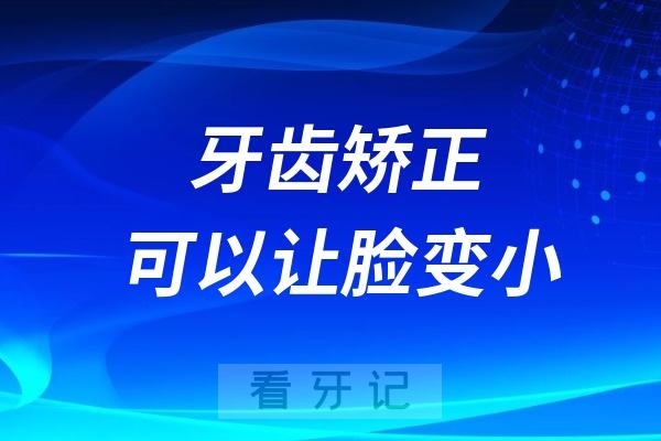 牙齿矫正可以让脸变小