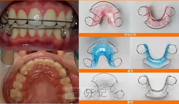 哈雷保持器长什么样附真实图片