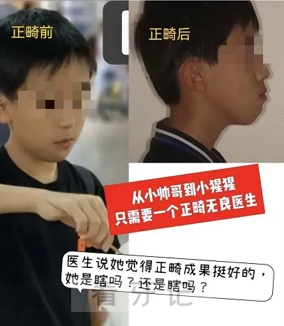 孩子正畸失败图片